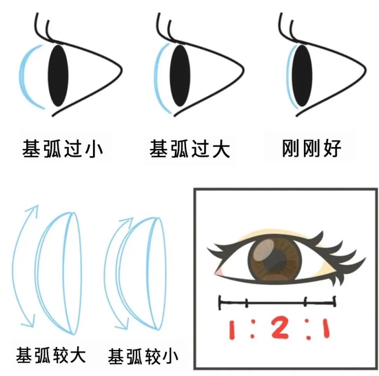 眼球基弧小是为什么,眼球基弧小什么原因