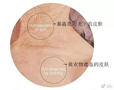 如上图示:80岁老人,脖子(阳光照射处)和锁骨下方(不见光处)的肌肤状态