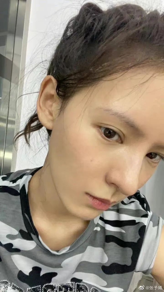 现在医美 是我草率了