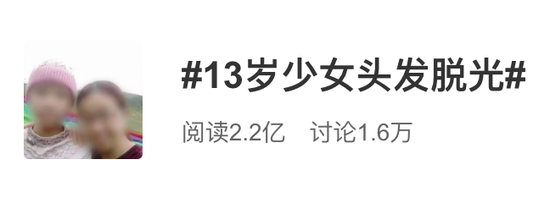 当代青年必读的防秃大法 再不看就晚了