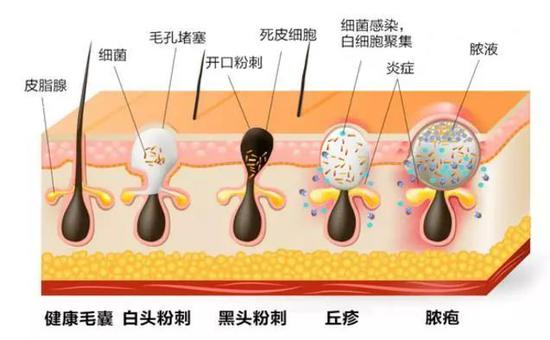 图片来源：搜狐琦琦护肤