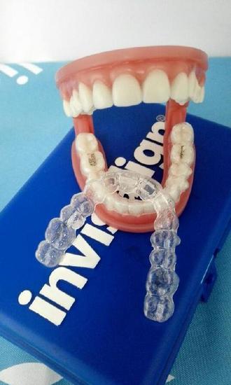 隐适美开启自信笑容之旅