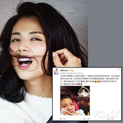angelababy牙齿美白