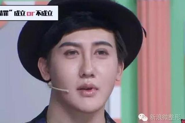 刘梓晨上真人秀洗白：我脸上确实有四、五十针，只是微整！|刘梓晨|整形 