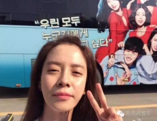 这些明星的鼻孔比尔康还抢镜!是鼻孔外露还是