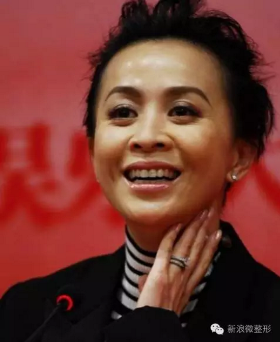这些明星的鼻孔比尔康还抢镜是鼻孔外露还是真鼻孔大