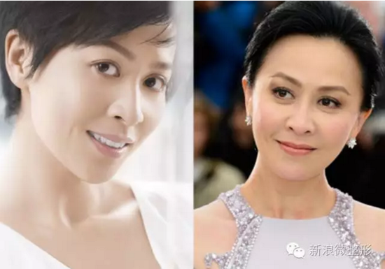 这些明星的鼻孔比尔康还抢镜!是鼻孔外露还是真·鼻孔大