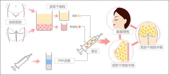 面部凹陷说明你老了|抗生素|面部|面部凹陷