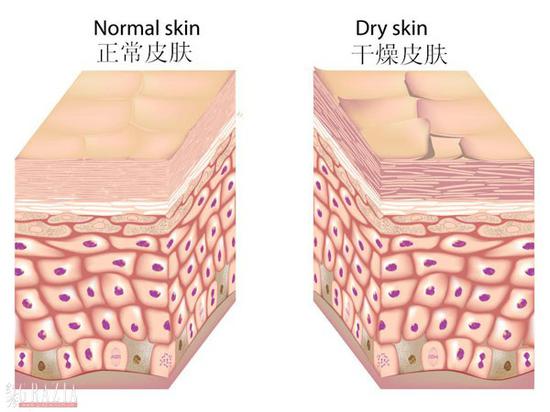 正常皮肤vs干燥皮肤