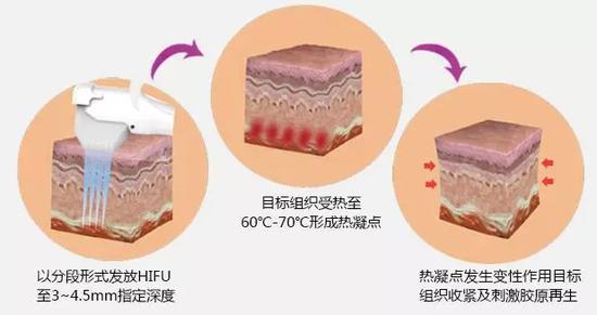 作用效果