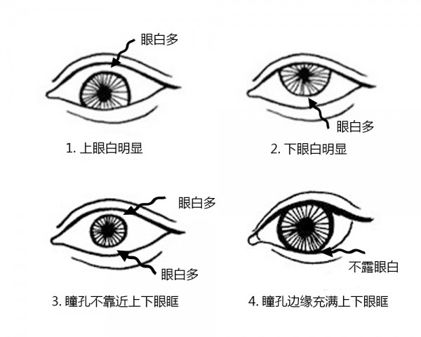 根据直径选择