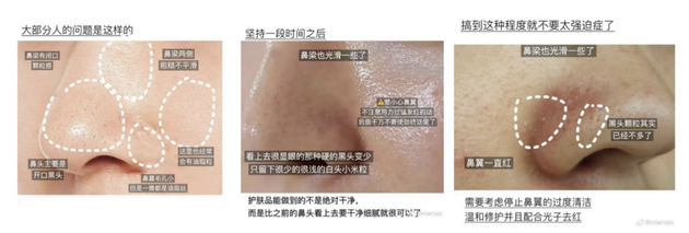 �����ܰ���ѱ��ӳ��ױ�ɾ��ĺ�ͷ������