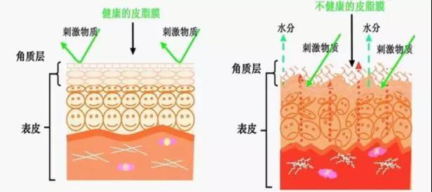 皮肤示意图