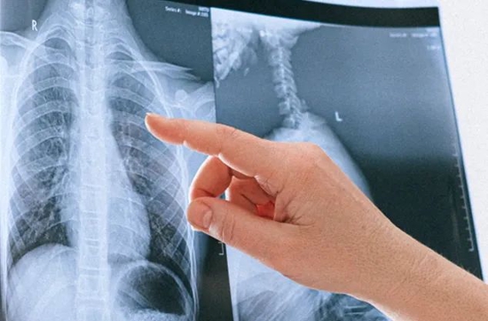 爱科百发：左手亏5亿，右手股权大激励，IPO募资近20亿......