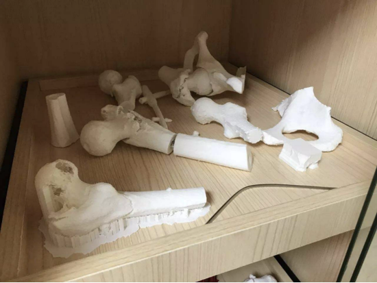 《imtoken添加波场币》林志颖3D脸部修复，这项近40年的“远古技术”为何难以普及？