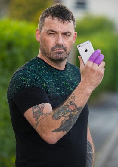 英国男子称iPhone 7在接电话时爆炸：幸好手没残