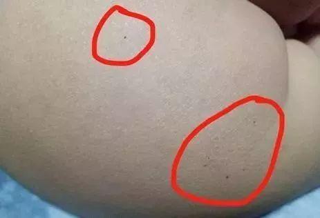 红黄蓝幼儿园虐童事件追问:扎针吃药 谁的病?