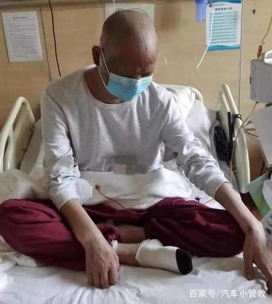 开奥迪车患白血病奥迪接锅?车主:保持通风最重