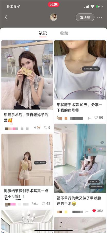 微博时尚博主张吉晶在微博上放出了浙大邵逸夫医院超声检查报告单