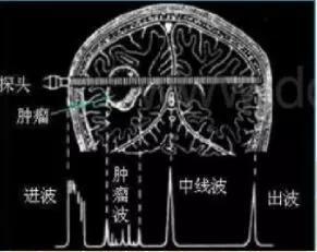 （图片来源：百度图片）