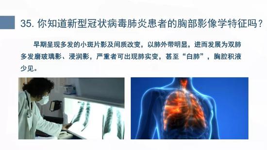 新型冠状病毒肺炎预防手册(武汉版)