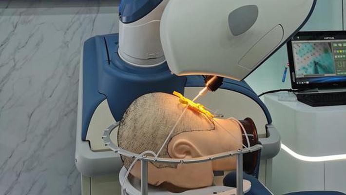 视频|植发手术辅助机器人升级版再现进博会 成活率可达95%