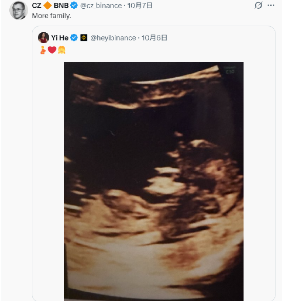 何一晒女儿B超照片，赵长鹏转发配文“More family”