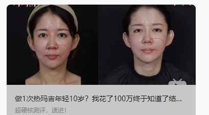 (图1 资料来源:新氧科技获客公众号)