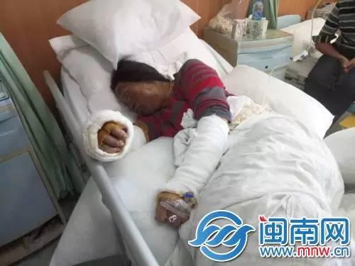 王剑波的母亲曾碰英烧伤严重