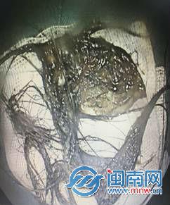 取出的部分头发