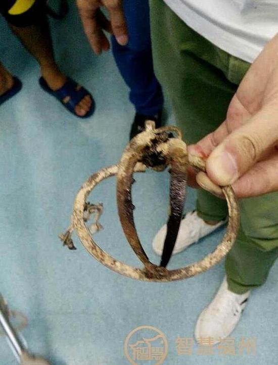 福州一小区惊现捕兽夹 流浪狗被夹住受伤需截肢