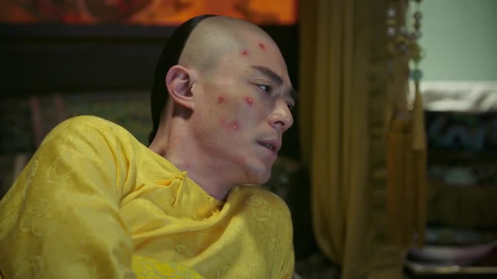 《如懿传》:乾隆屁屁上长满疥疮,如懿想伺候却