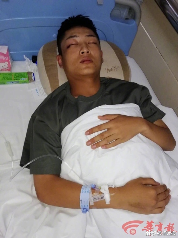 泡椒腌制最好吃的方法