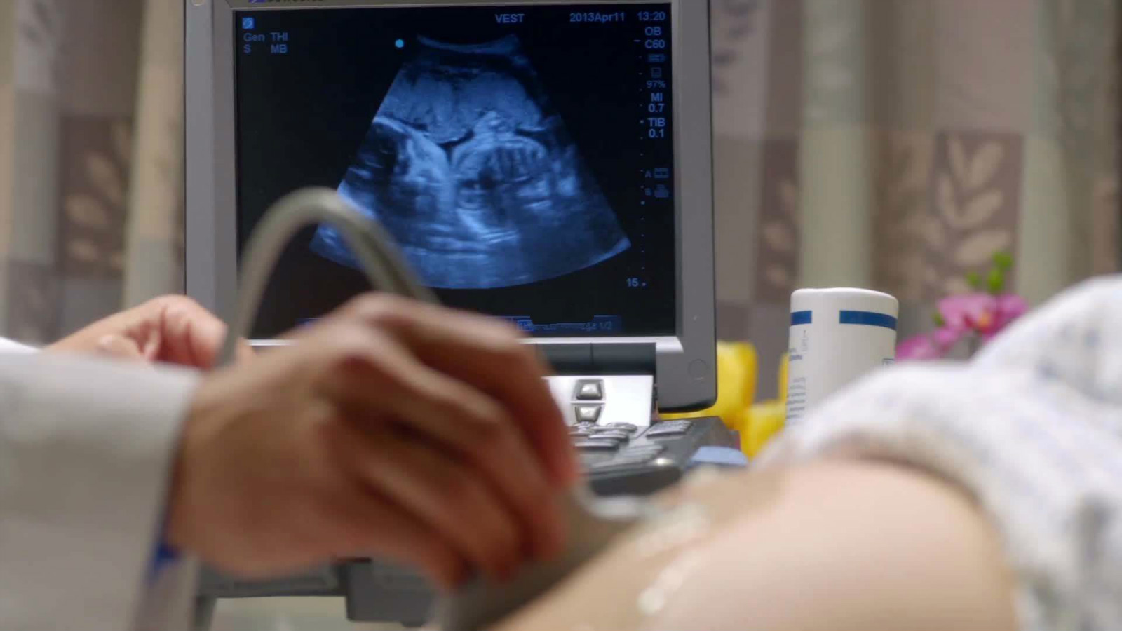 问下早期肝硬化怎么查出来？