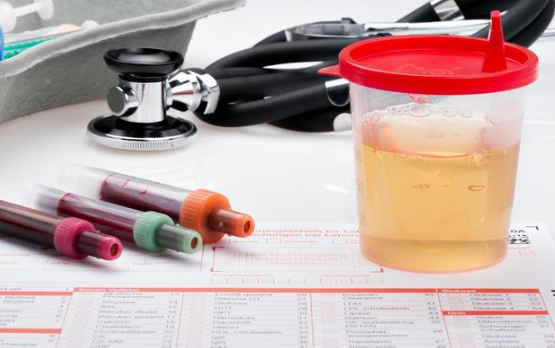 肌酐明明已升高,医生却不着急治疗?非等到肾衰