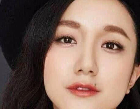 出道18年没走红,点掉嘴角一颗痣后,如今大火还