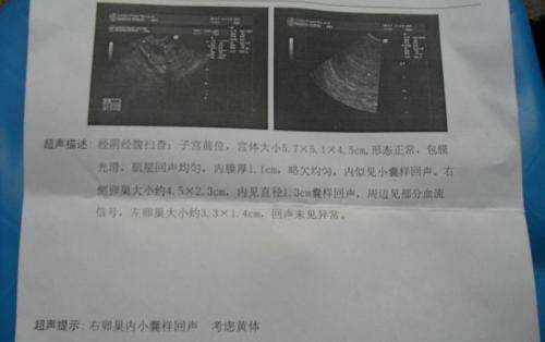 孕妈怀孕,B超单检查发现肚子却有3个东西,难道