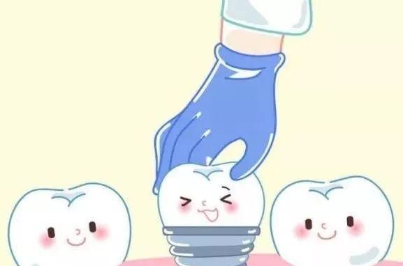 人口种植牙好吗_半口种植牙成活率高吗