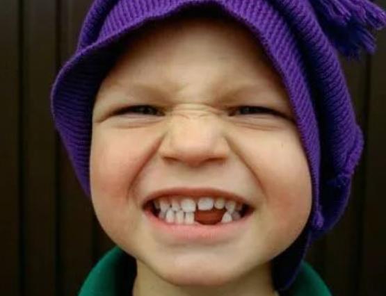 孩子几岁开始换乳牙?换牙年龄早晚,对他的发