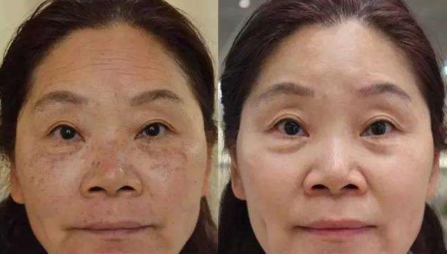 怎么淡斑祛斑，李佳琦推荐的祛斑产品真的有效吗？