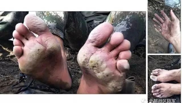 你看过消防员救火后的手脚吗?看完照片网友动