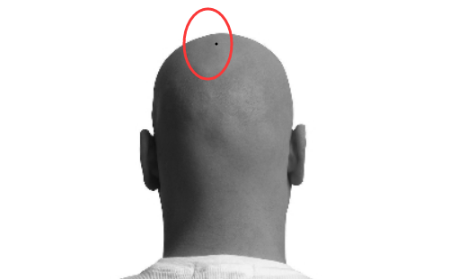 男人身上四处吉痣,命中藏财,有福气!