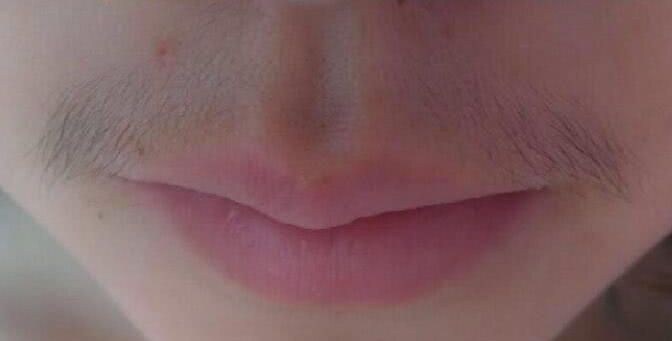 女生唇毛浓密太难看?千万别剃,用这招唇毛不再长,从此告别唇毛