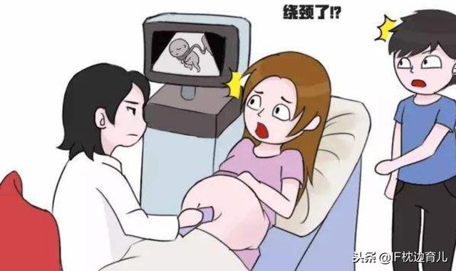 脐带绕颈两周建议我顺产?这医生不专业吧?医