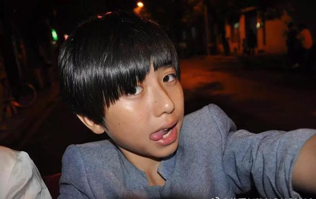 蔡徐坤机场被堵也过敏?脖子后面全是红疹子,粉