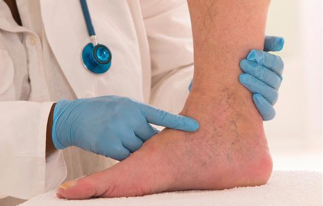 尿酸高于420的人,有3种症状,肾脏已受牵连