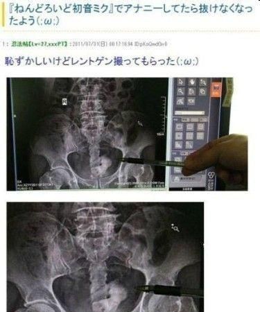 这些充满魔性的初音未来手办你见过吗？网友：竟然还有寂静岭版