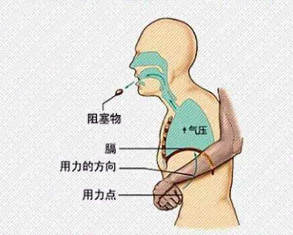 宝宝被食物噎到怎么办？学会海姆立克急救法，把握住黄金5分钟