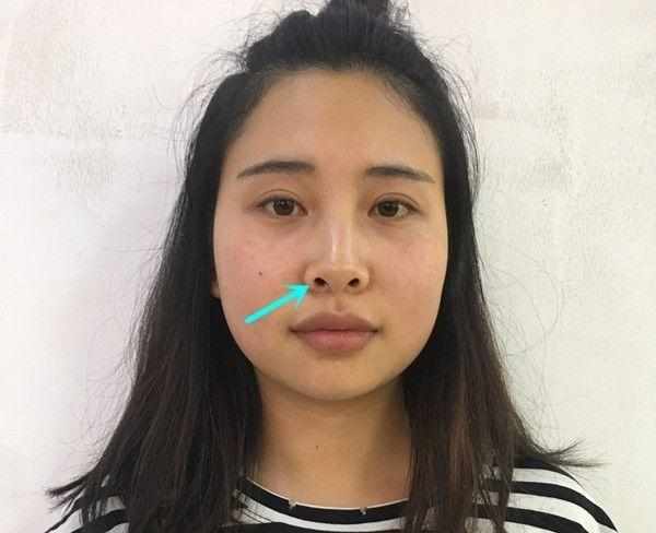 美不美看鼻子!拥有4种