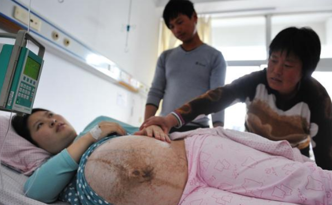 孕妇剖腹三胞胎,20多名家属陪产,可孩子出生后婆婆
